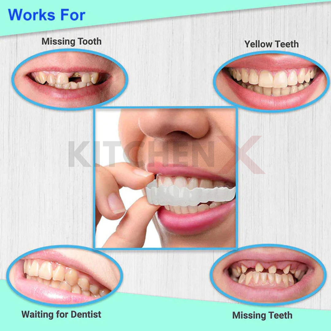 Snap on Smile Teeth Veneer Braces